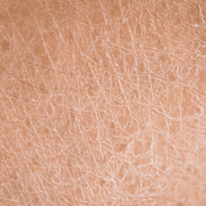close up picture of dull skin