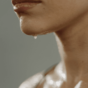 excess sweating in women