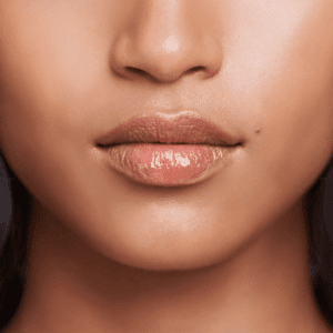 thin lip problems for women