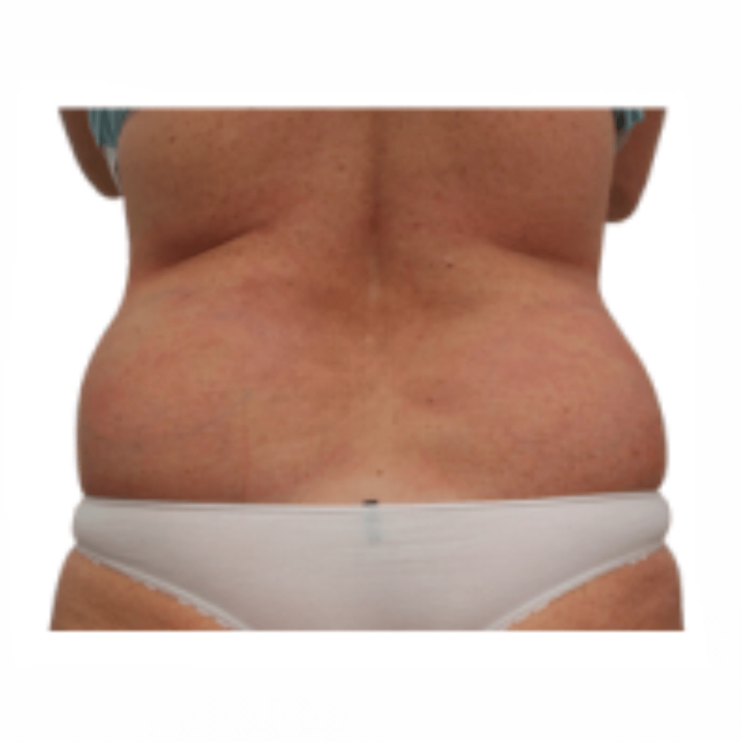 aqualyx after picture for saddlebags